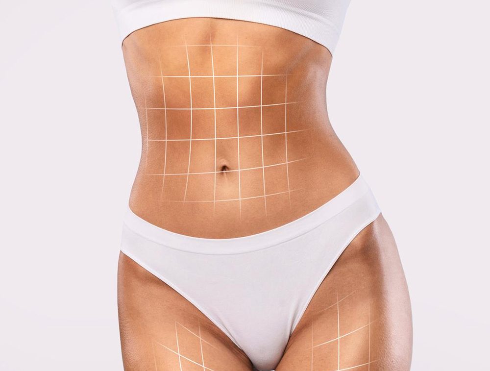 What is CoolSculpting?