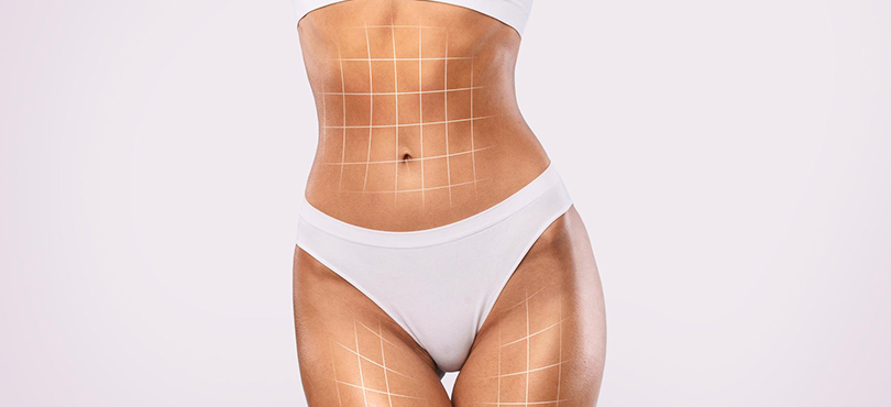 What’s the Difference Between 3D Lipo and CoolSculpting