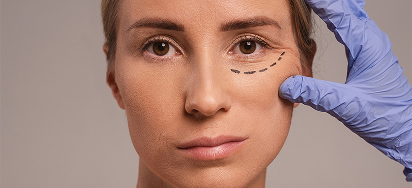 How Long Do Under Eye Fillers Last?