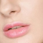 Tips on Reducing Bruising and Swelling After Lip Filler