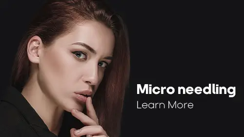 Microneedling