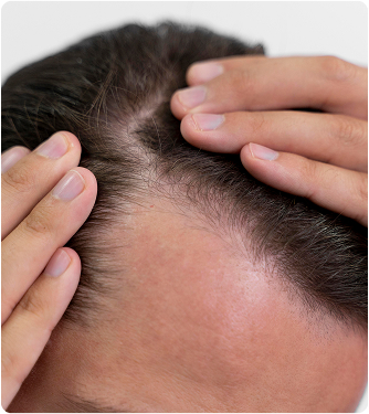 HAIR CLINIC