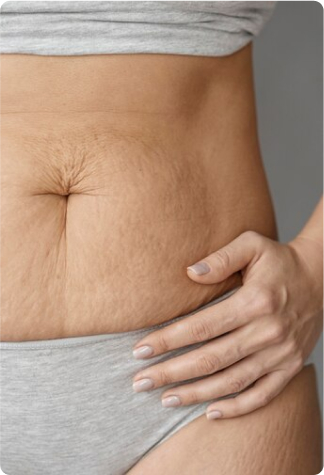 Laser Scar Removal