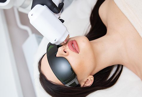 Laser Skin Tightening