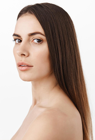 Melasma