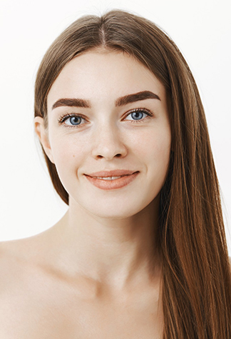 Melasma
