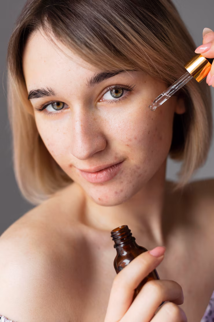 Acne Treatment