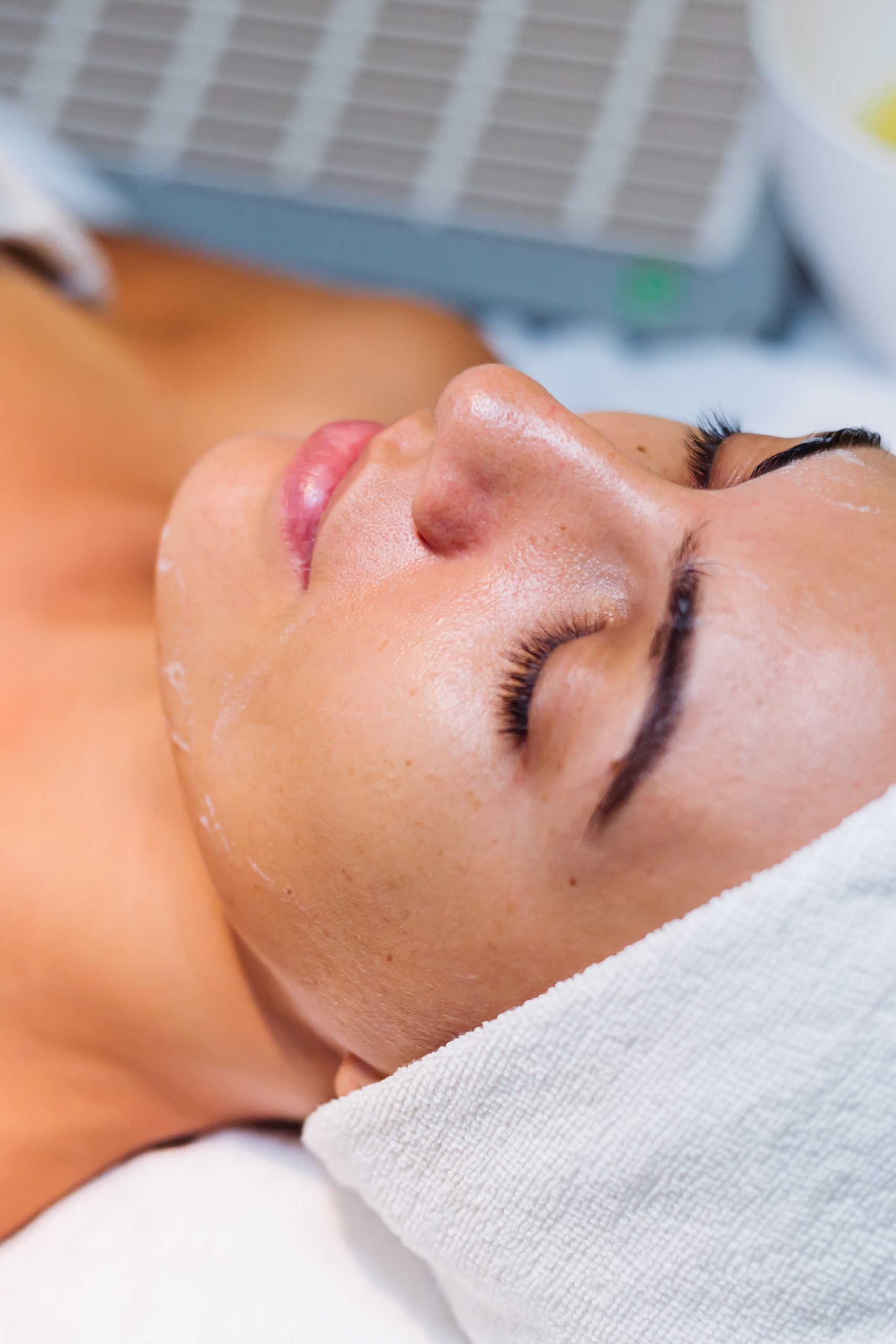 Chemical Peel