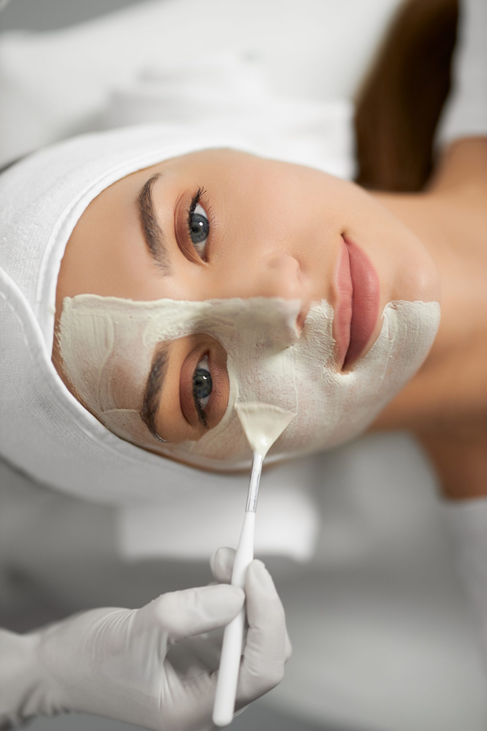 Chemical Peel