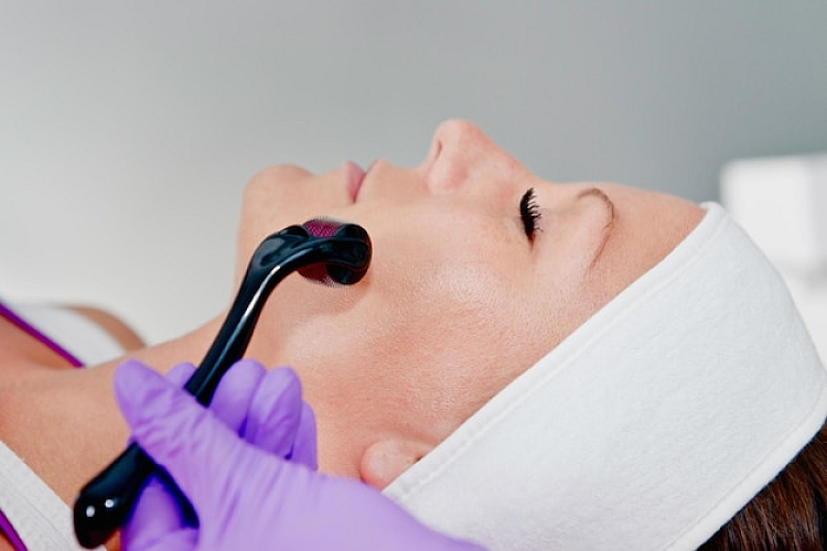 What is a Micro Laser Peel?