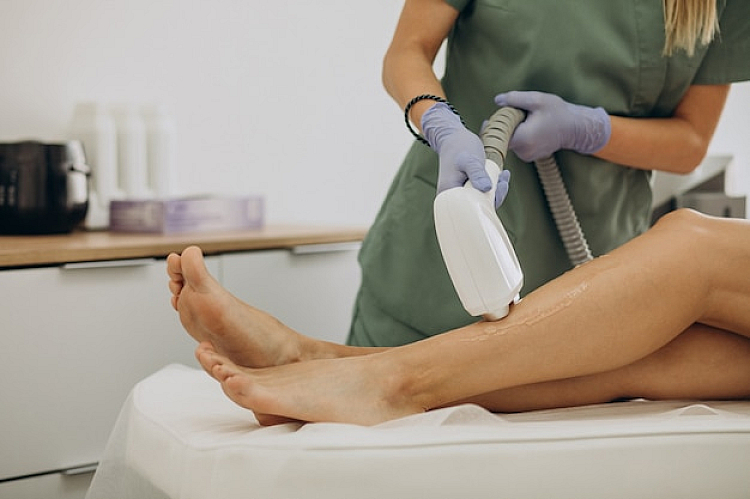 Benefits of Laser Vein Removal
