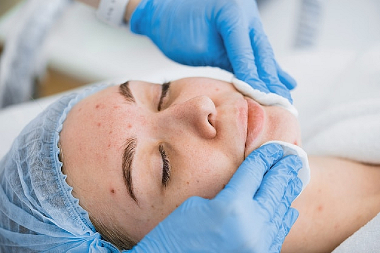 Ideal Candidates for Micro Laser Peel