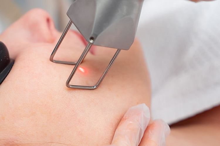 Mole Removal Treatments