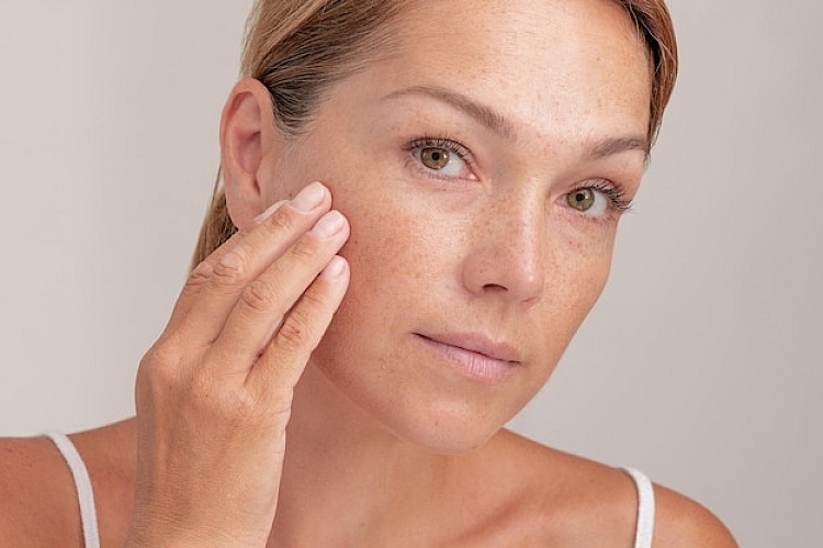 Age Spot Removal Treatment