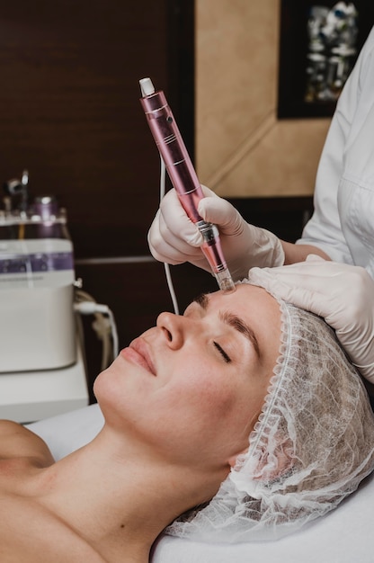 Micro Laser Peel
