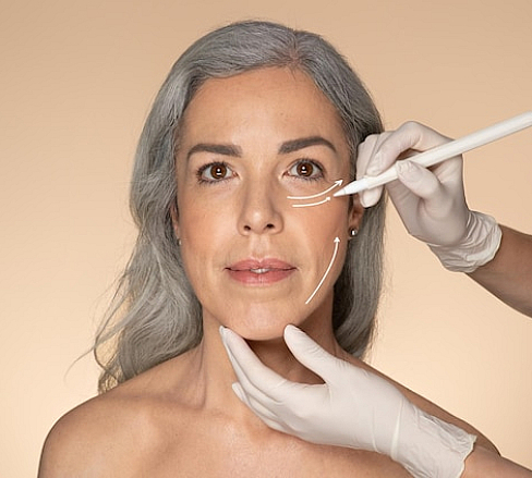 How Does Soft Lift™ Work?