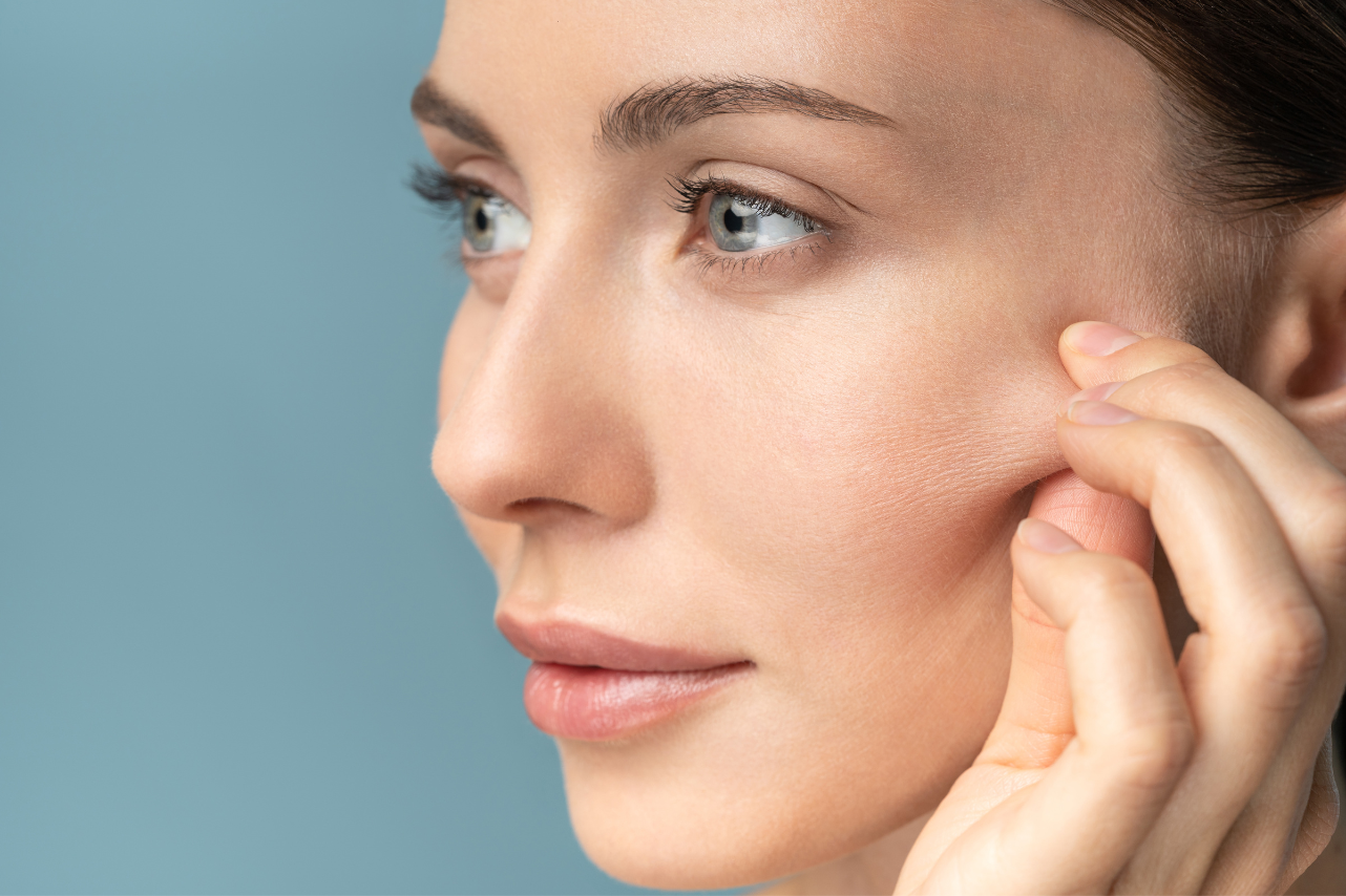 Acne Scars