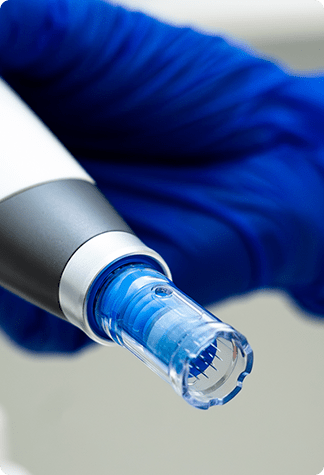 Microneedling