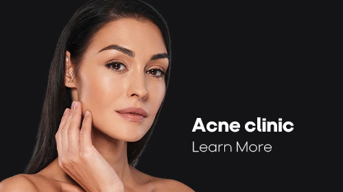 Acne Clinic