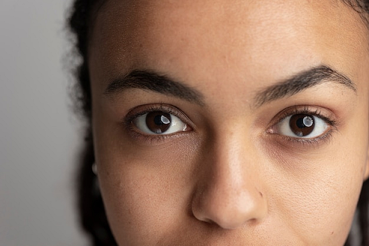 Understanding Under Eye Dark Circles