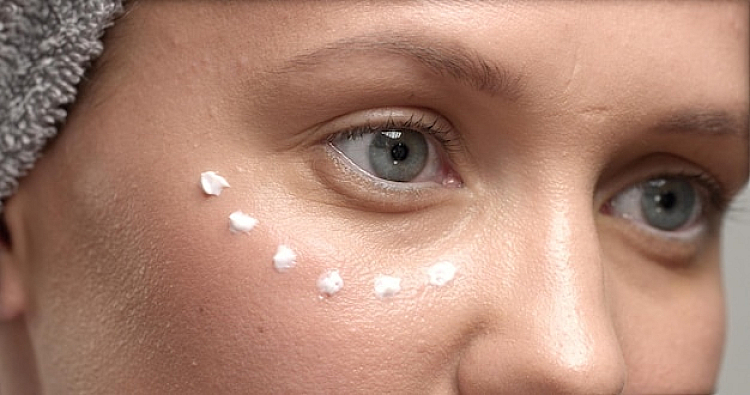 Characteristics of Under Eye Dark Circles