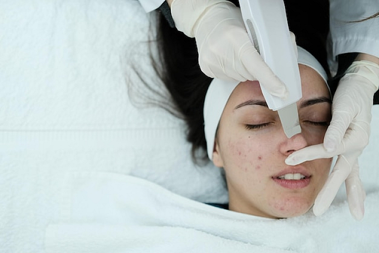 Types of Acne We Treat