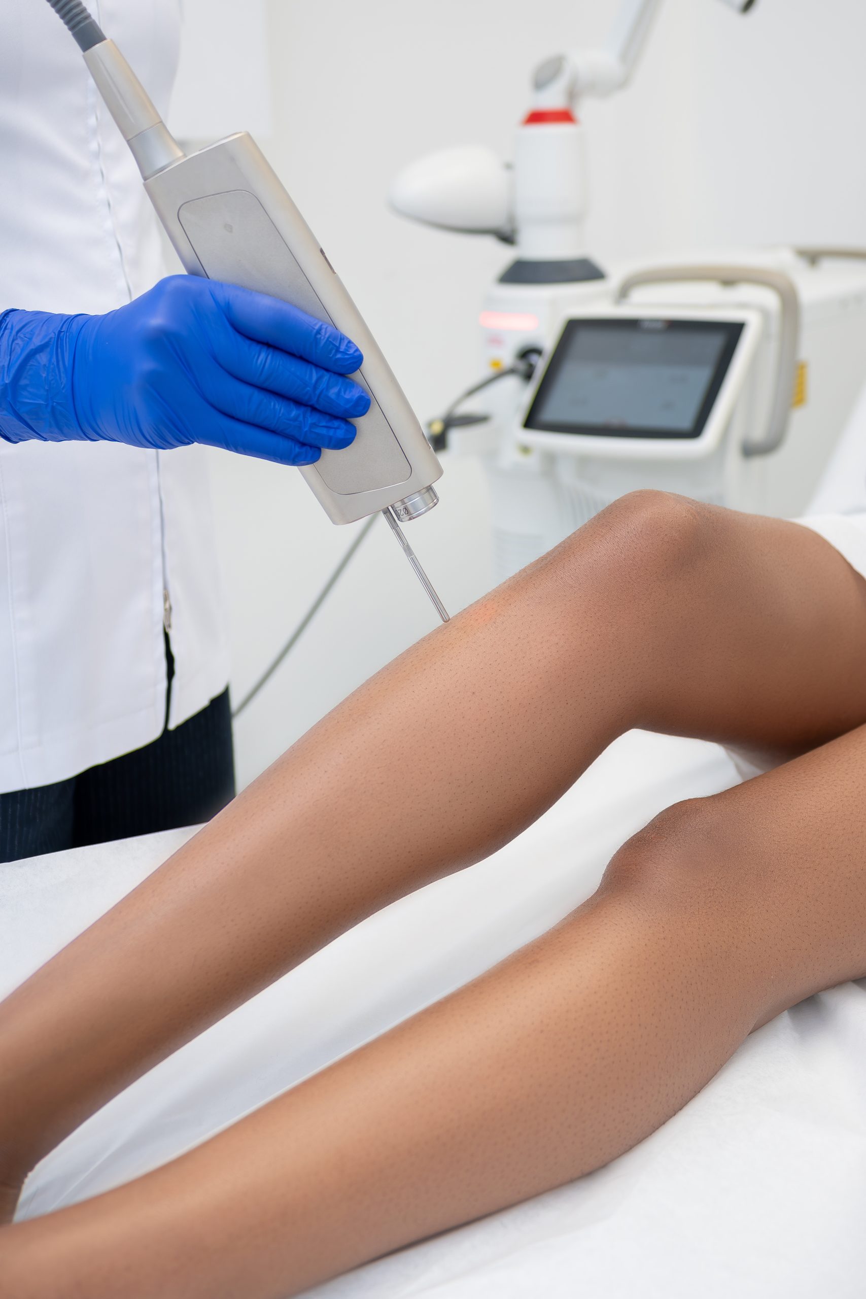 Laser Hair Removal