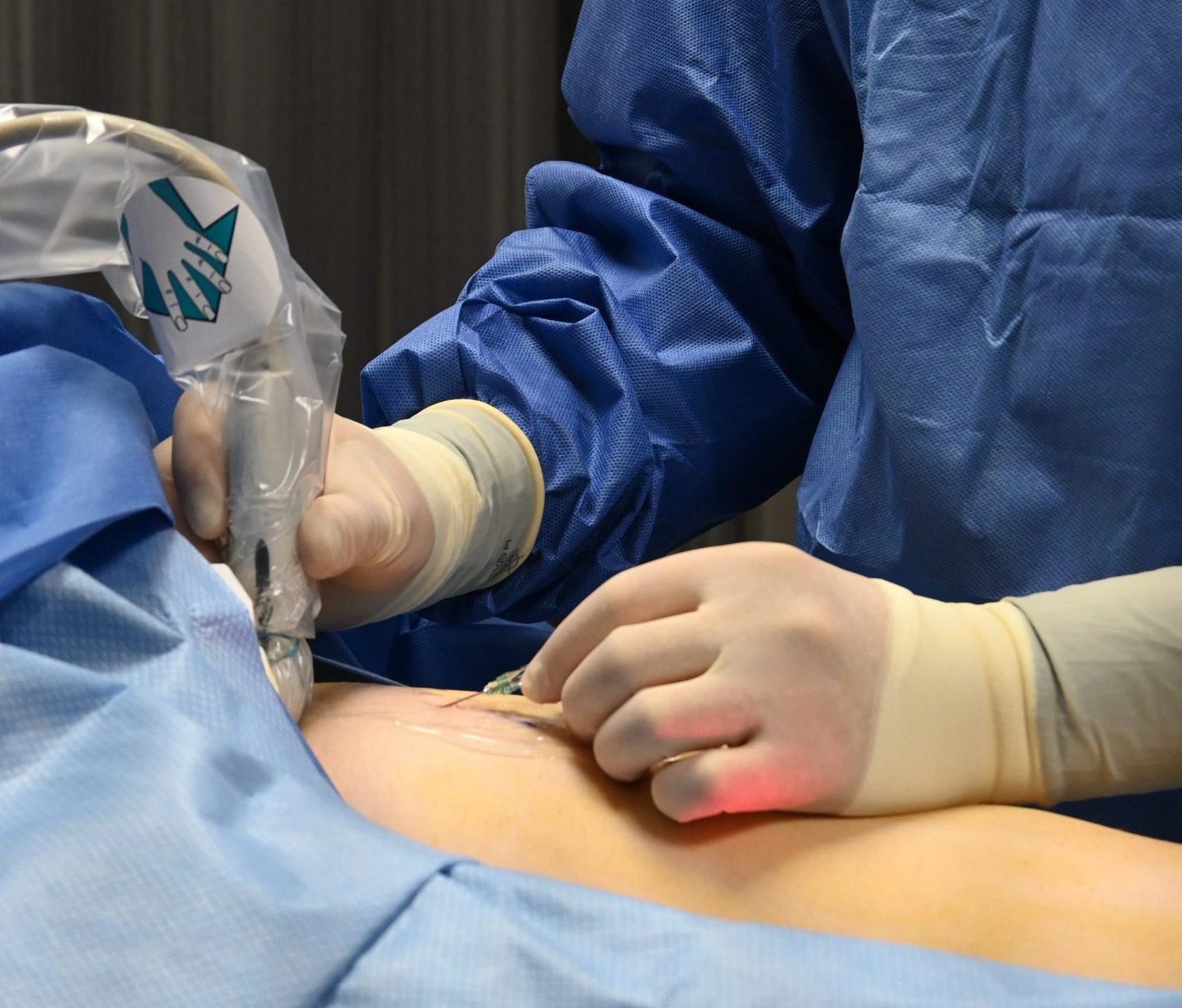 What To Expect of The VenaSeal™ Procedure