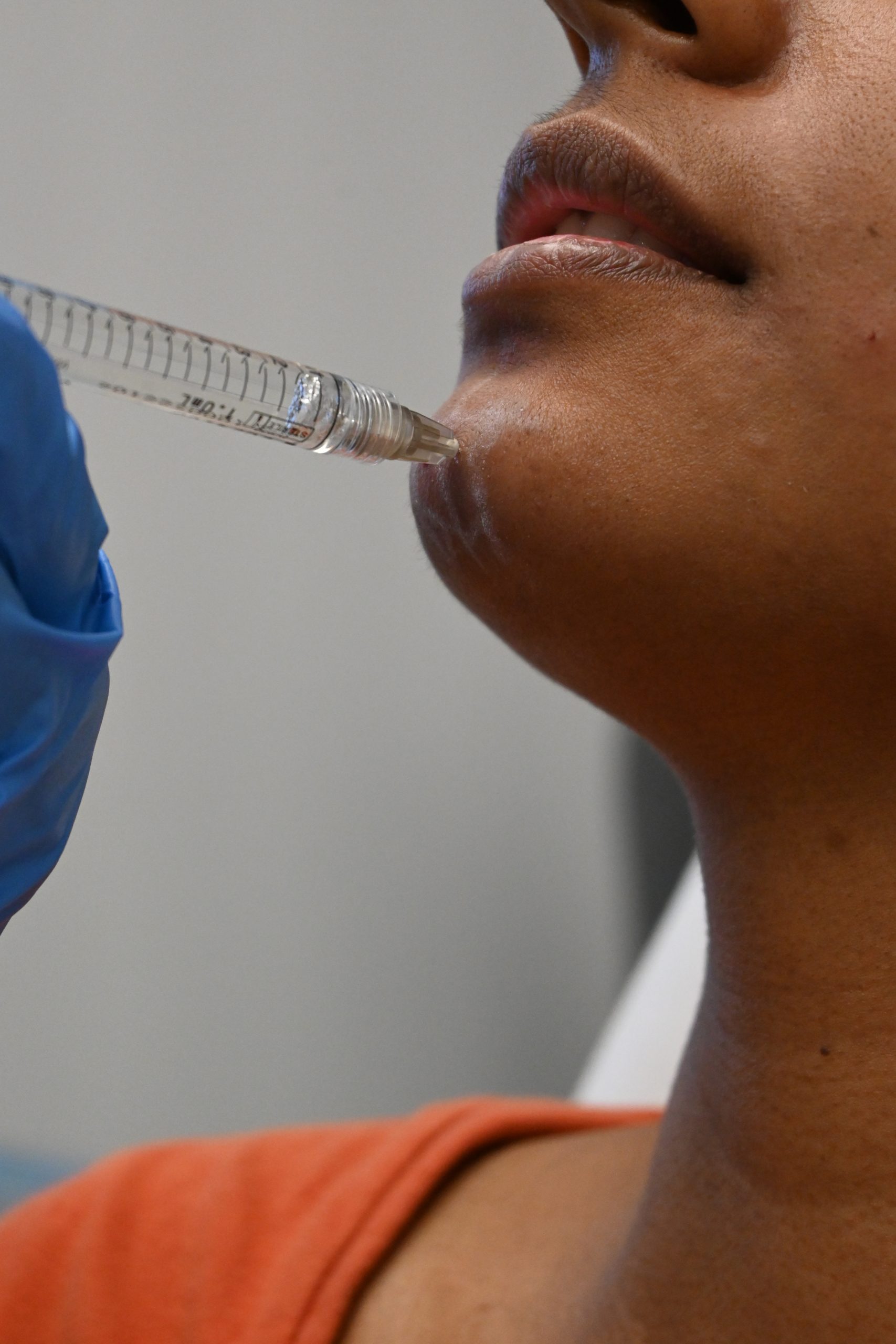 What Are Dermal Fillers?
