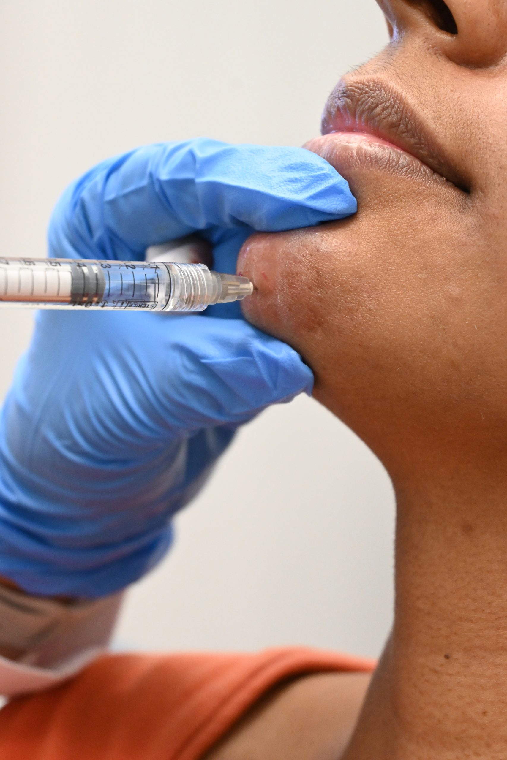 What is Juvéderm®?