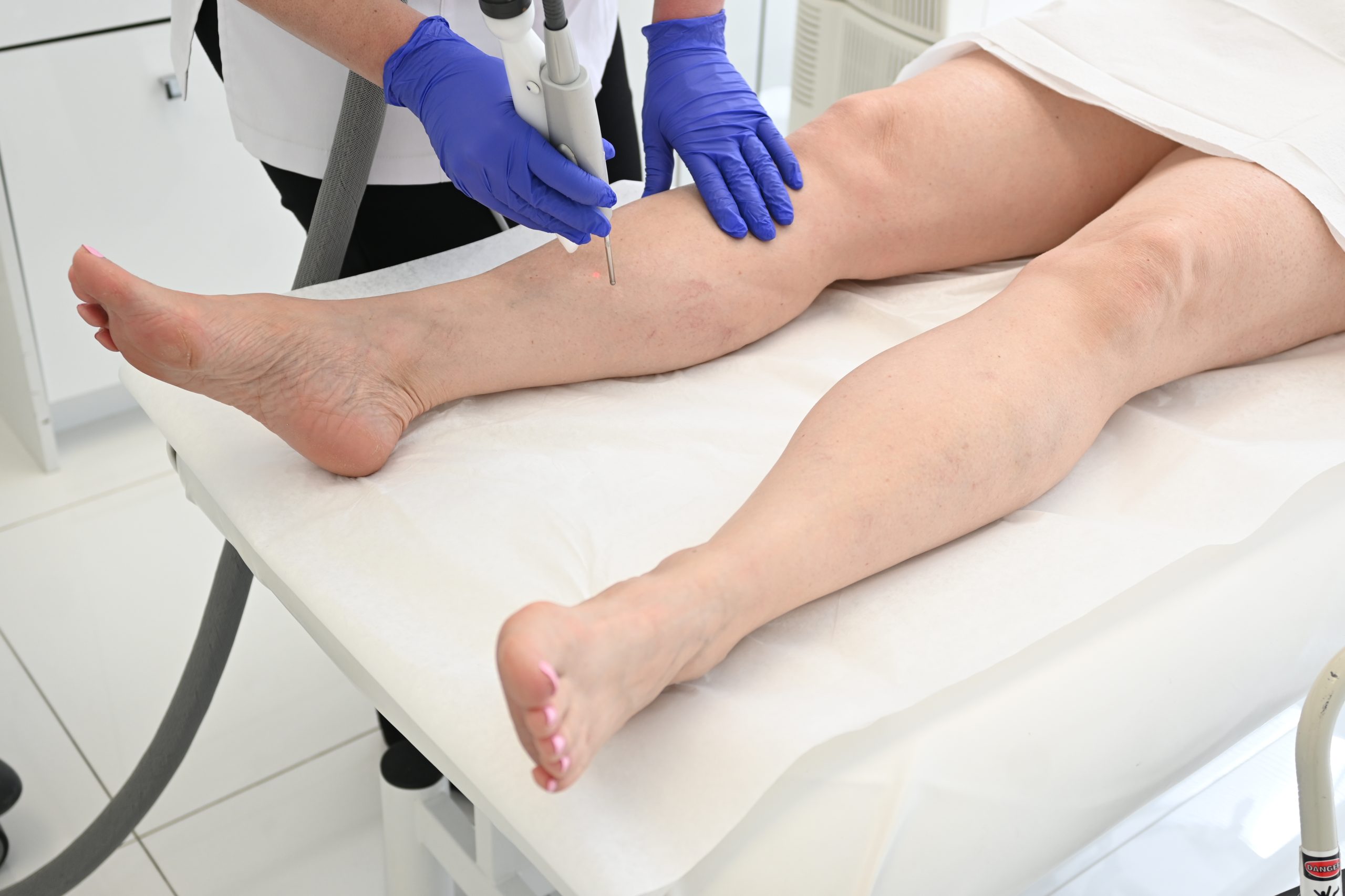 Understanding Vein Conditions