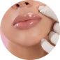 Lip fillers