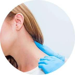 Mole removal