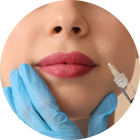Nasolabial folds
