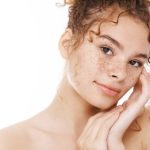 Hyperpigmentation Treatment Toronto