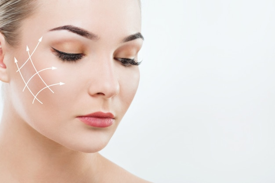 Thread Lift vs. Face Lift Surgery